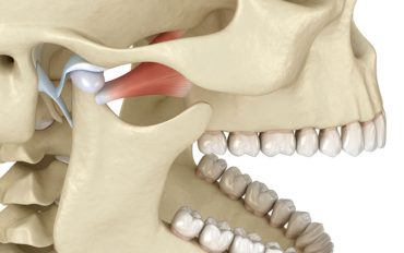 De ce mă doare maxilarul când mestec? Află totul despre disfuncția ATM