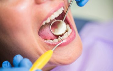 implant dentar