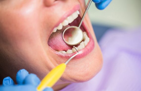 implant dentar
