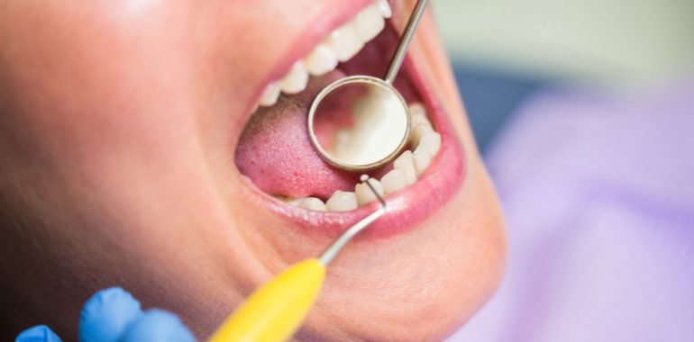 implant dentar